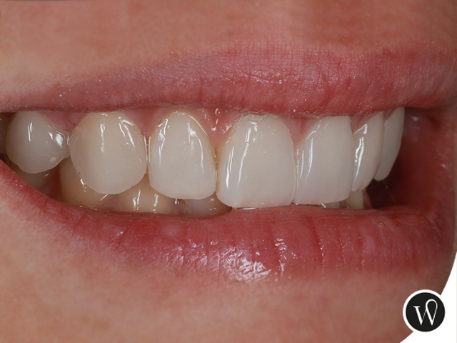 Odontologo en Playa del Carmen