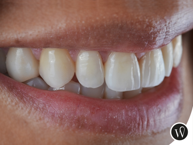 Odontologo en Playa del Carmen